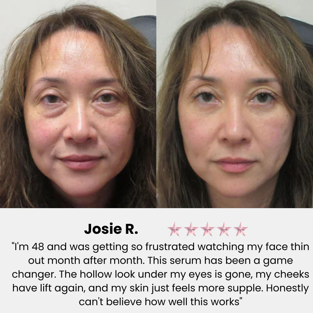 nūda™ Volufiline Deep Collagen Power Serum