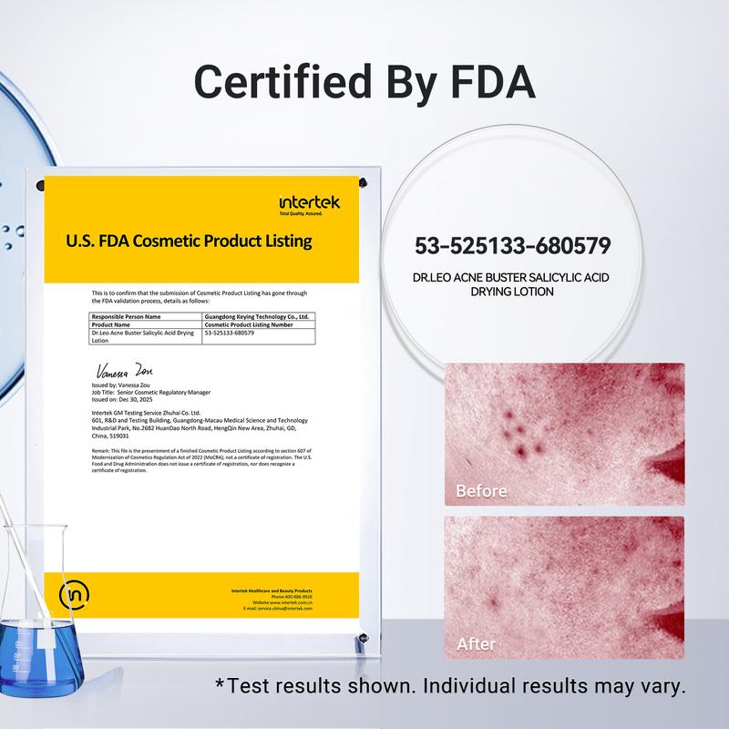 nūda™ Acne Buster Fast-Acting Drying Lotion