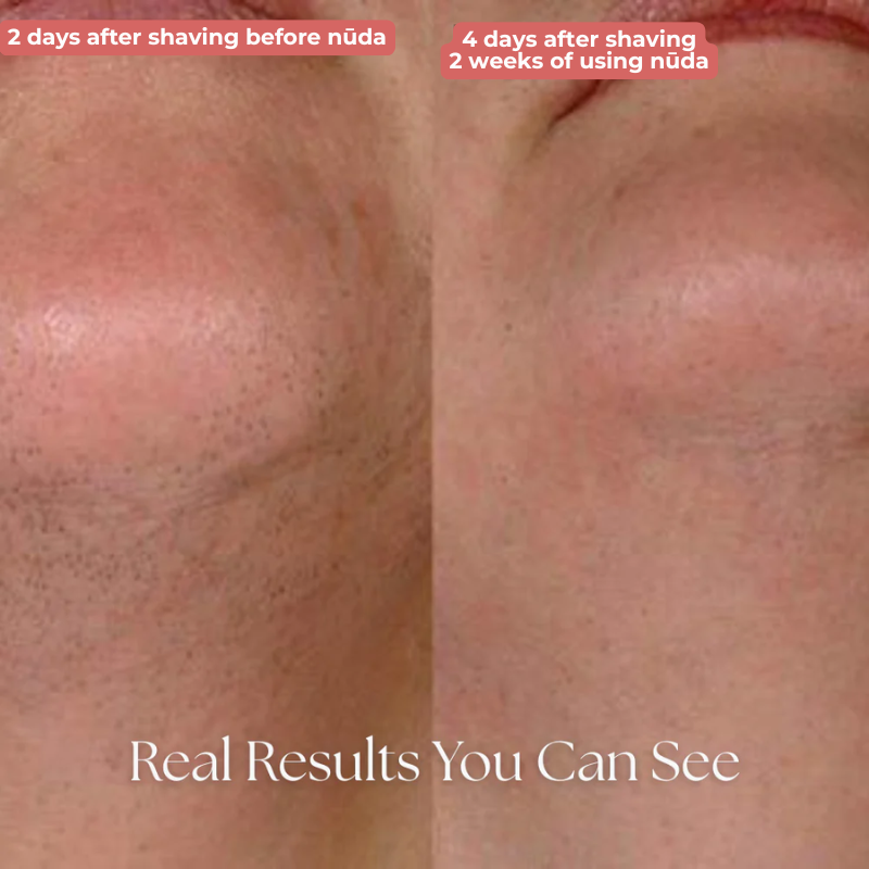 nūda™ Cyperus Rotundus Oil