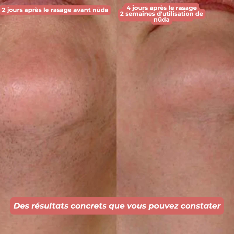 nūda™ Huile de Cyperus Rotundus