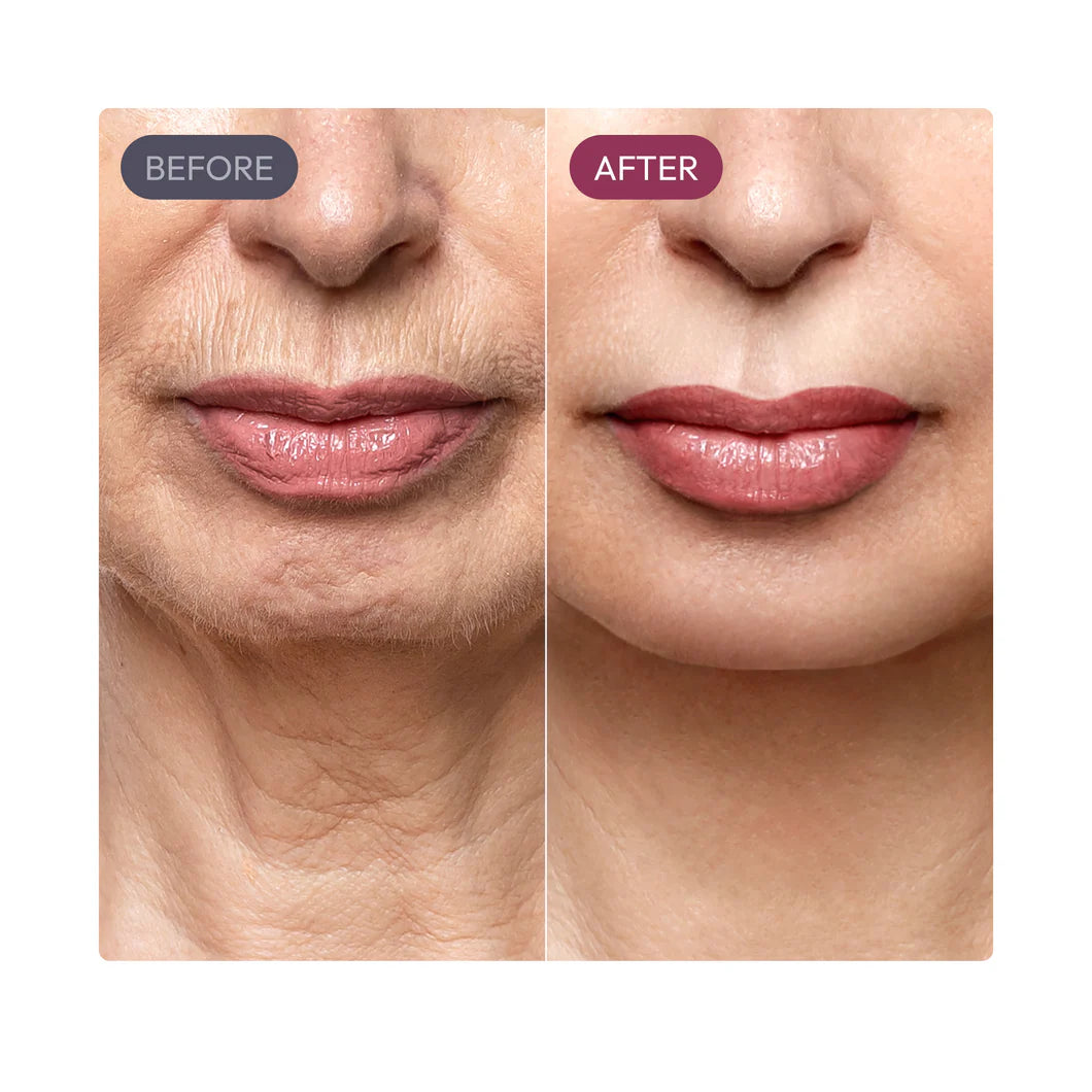 nūda™ Madeca Cure Time Reverse Cream