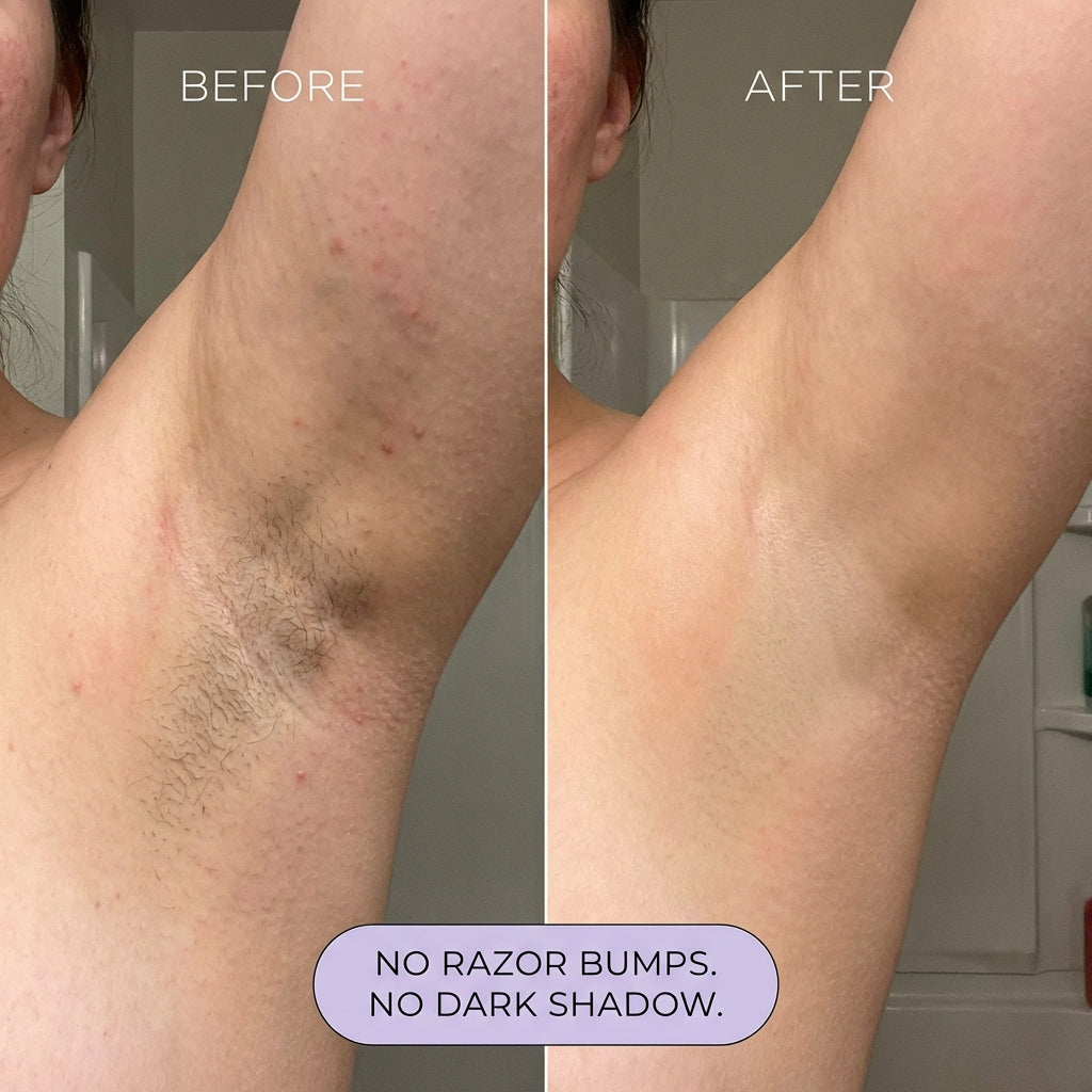 nūda™ Pain-Free Hair Removal