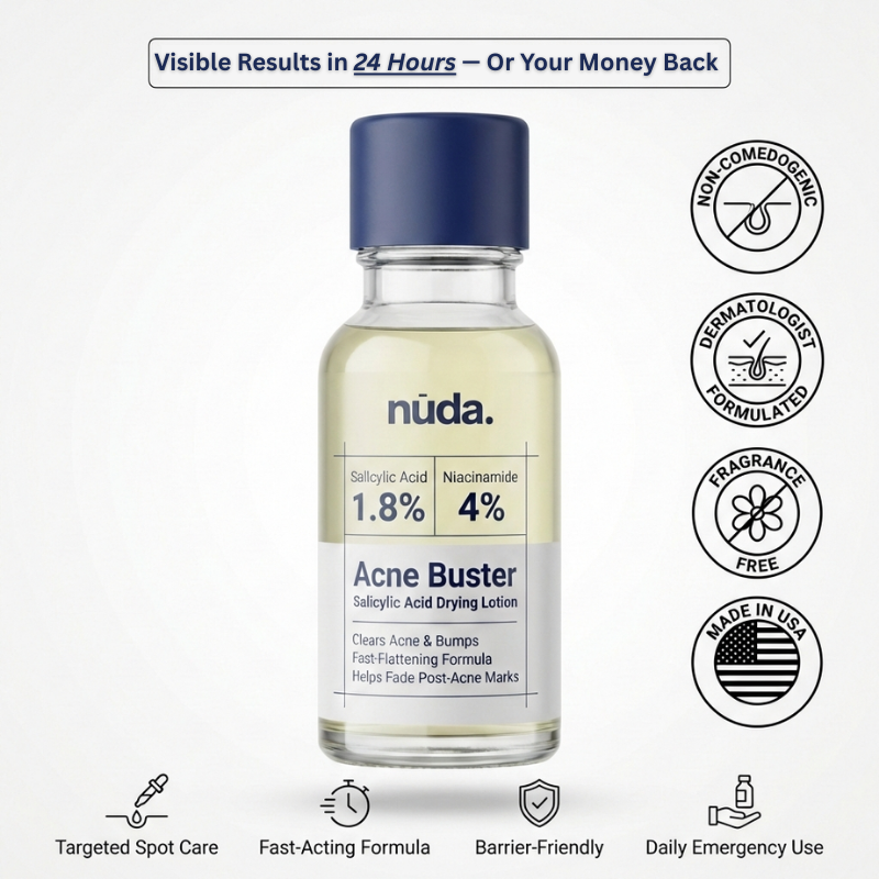 nūda™ Acne Buster Fast-Acting Drying Lotion